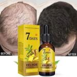 7 Days Eelhoe Germinal Oil – Fast Hair Growth & Nourishment